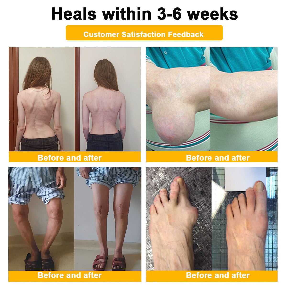 ADNOON® Only 10 boxes left! ⭐⭐We offer you an additional 30% discount! Restore health and confidence. Don't miss out now, there won't be another chance next year.
