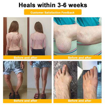 ADNOON® Only 10 boxes left! ⭐⭐We offer you an additional 30% discount! Restore health and confidence. Don't miss out now, there won't be another chance next year.