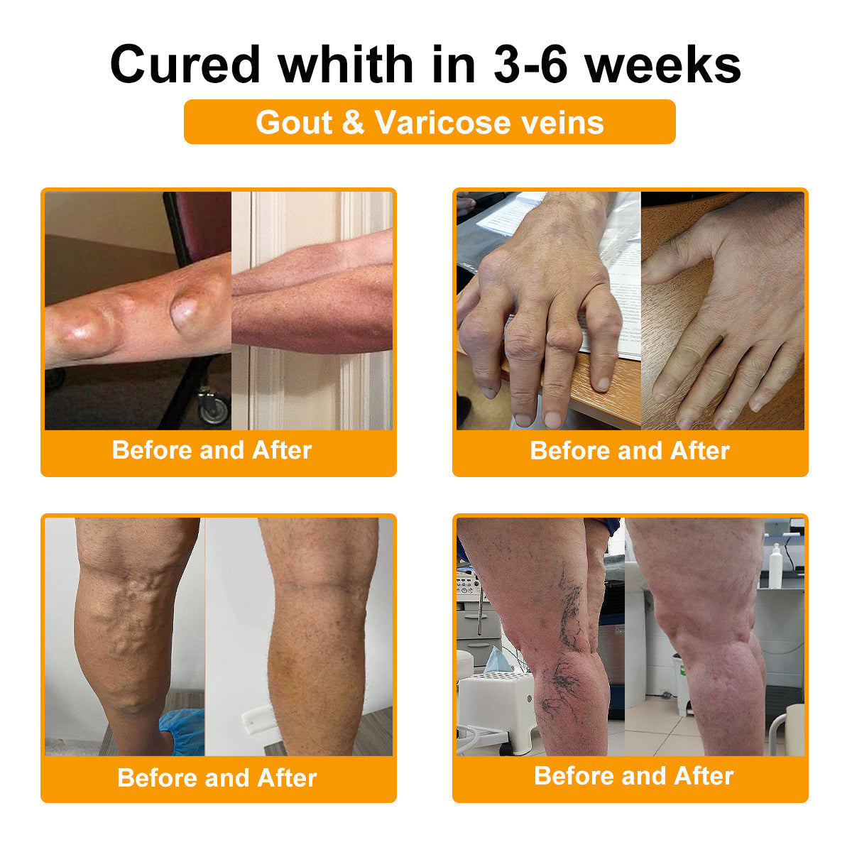 ADNOON® Only 10 boxes left! ⭐⭐We offer you an additional 30% discount! Restore health and confidence. Don't miss out now, there won't be another chance next year.