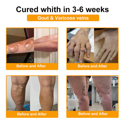 ADNOON® Only 10 boxes left! ⭐⭐We offer you an additional 30% discount! Restore health and confidence. Don't miss out now, there won't be another chance next year.