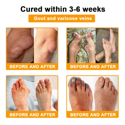 ADNOON® Only 10 boxes left! ⭐⭐We offer you an additional 30% discount! Restore health and confidence. Don't miss out now, there won't be another chance next year.
